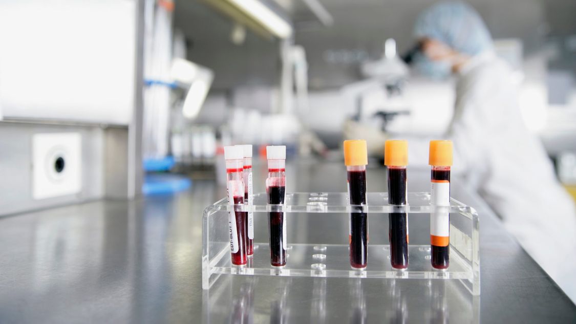 Этапы обработки крови и плазмы в фармацевтическом производстве