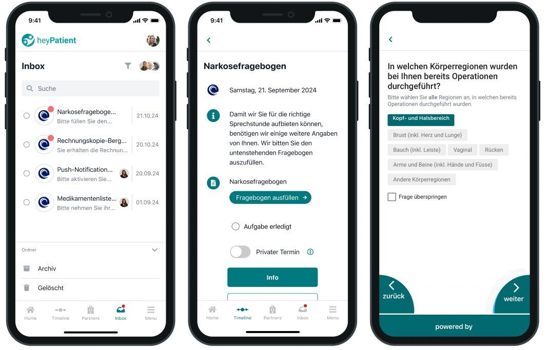 Integrarea ușoară a chestionarelor