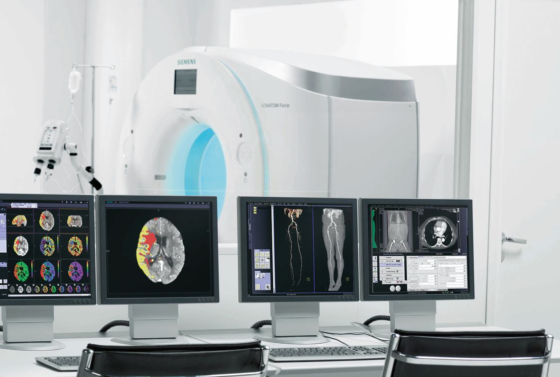 MRI machine with several computers rending MRI images