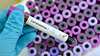 Intelligent disinfection robots help fight the virus