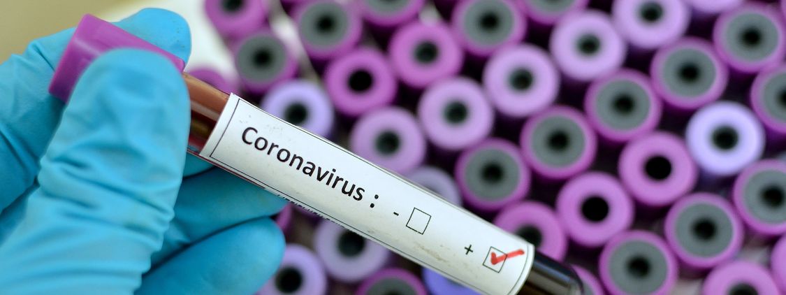 amostra positiva de teste de coronavirus segurada por maos usando luvas azul claro